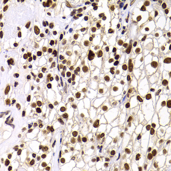 PHIP Polyclonal Antibody