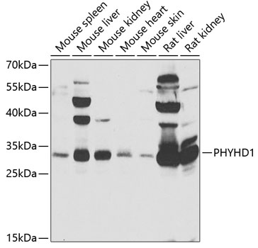 PHYHD1 Polyclonal Antibody