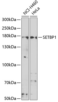 SETBP1 Polyclonal Antibody