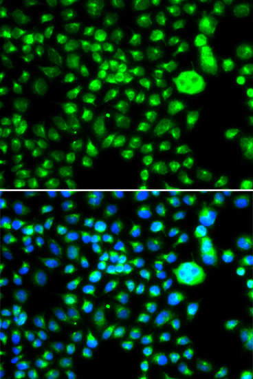 SMCHD1 Polyclonal Antibody
