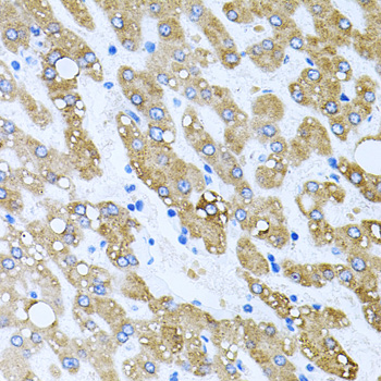 TOB2 Polyclonal Antibody