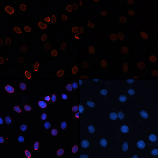 Acetyl-Histone H3-K56 pAb