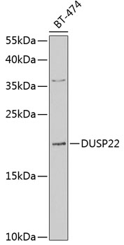 DUSP22 Rabbit Polyclonal Antibody