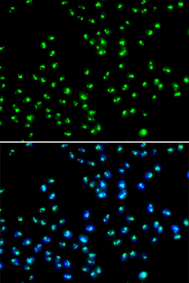 NAT10 Rabbit Polyclonal Antibody