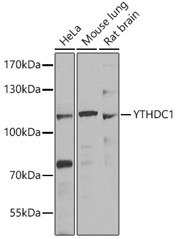 YTHDC1 Polyclonal Antibody