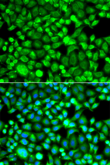 PSMB8 Rabbit Polyclonal Antibody