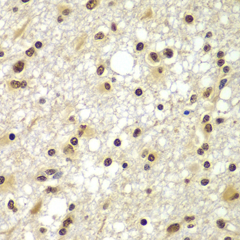 ZNF20 Polyclonal Antibody