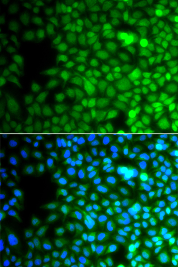 ZNF195 Polyclonal Antibody