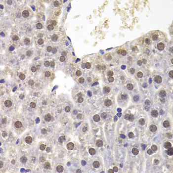 PRDM5 Rabbit Polyclonal Antibody