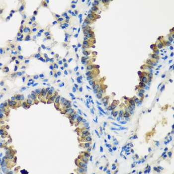 CYP2F1 Polyclonal Antibody