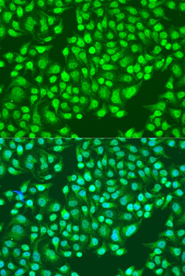 ITGA2 Polyclonal Antibody