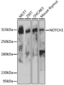 NOTCH1 Polyclonal Antibody