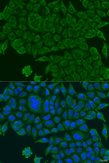 BCS1L Polyclonal Antibody