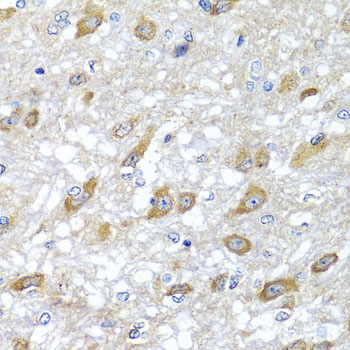 HSPA6 Polyclonal Antibody