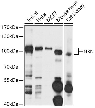 NBN Rabbit Polyclonal Antibody