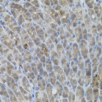 UBE2A Rabbit Polyclonal Antibody