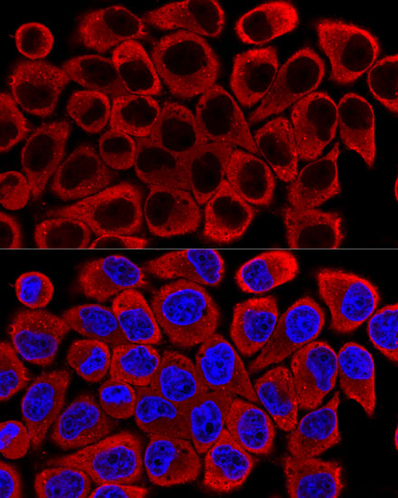 SQSTM1 / p62 Polyclonal Antibody