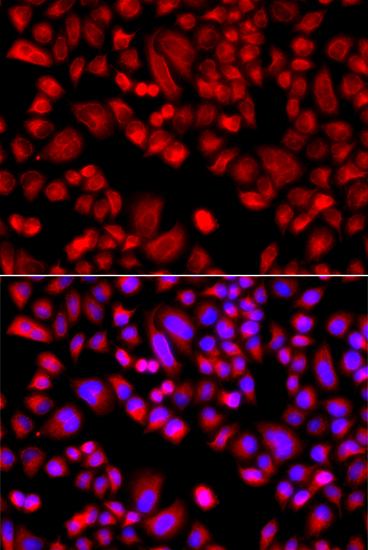 ARPC3 Polyclonal Antibody