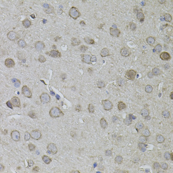 CKAP4 Rabbit Polyclonal Antibody