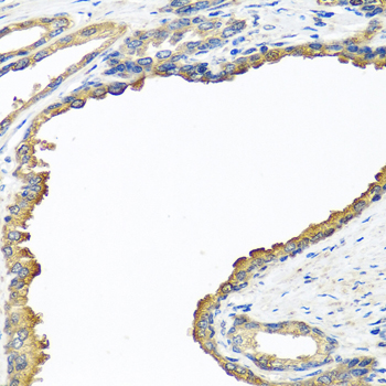 NYX Polyclonal Antibody