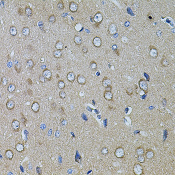 CHRFAM7A Rabbit Polyclonal Antibody