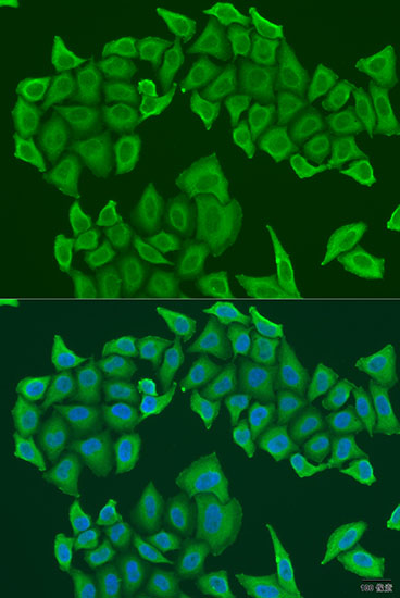 HAUS8 Polyclonal Antibody