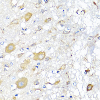 CALHM1 Polyclonal Antibody