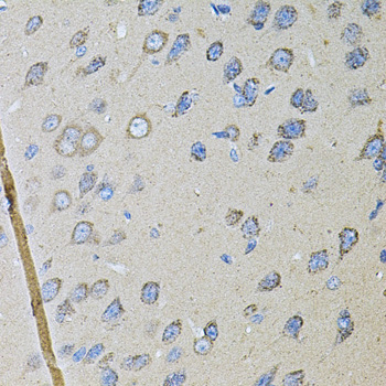 CDH16 Rabbit Polyclonal Antibody