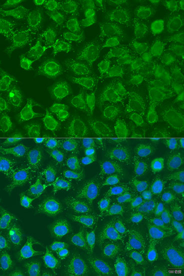 EIF2B1 Polyclonal Antibody