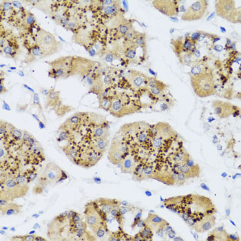 CHIC2 Polyclonal Antibody