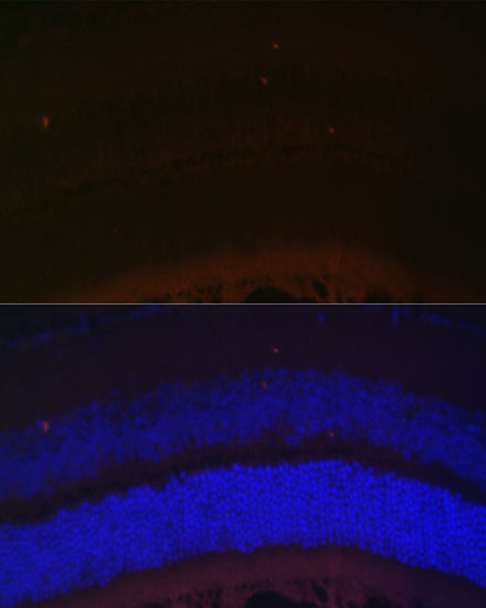 RDH5 Polyclonal Antibody