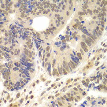 LHX4 Polyclonal Antibody