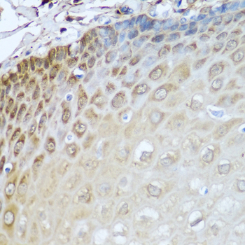 ADH1C Polyclonal Antibody