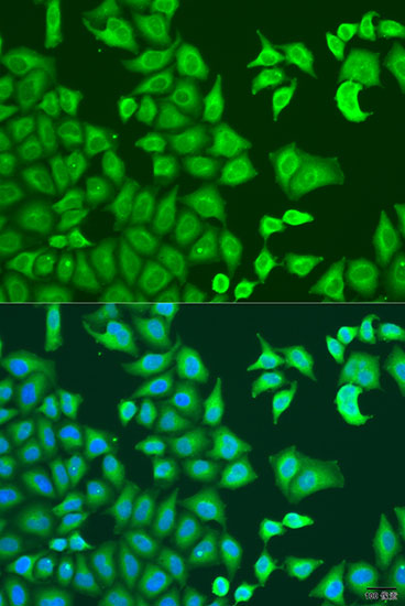 CAPZB Polyclonal Antibody