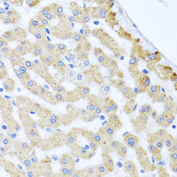 CETN3 Rabbit Polyclonal Antibody