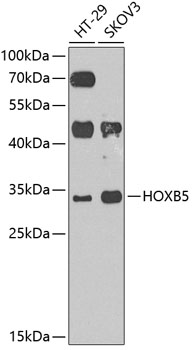 HOXB5 Rabbit Polyclonal Antibody