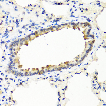IFNW1 Rabbit Polyclonal Antibody