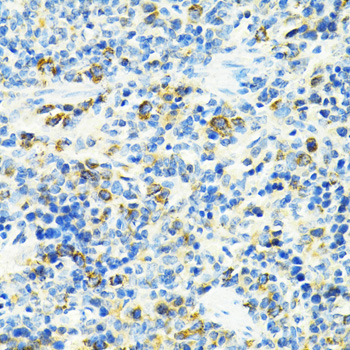 SLC25A11 Rabbit Polyclonal Antibody