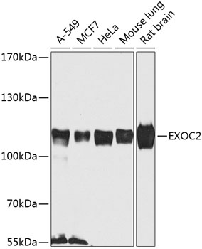 EXOC2 Polyclonal Antibody