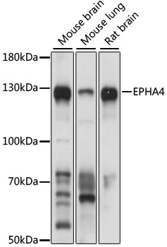 EPHA4 Rabbit Polyclonal Antibody