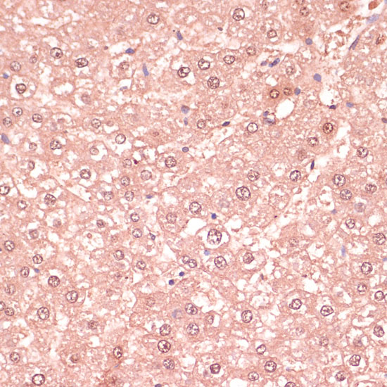 RNF5 Rabbit Polyclonal Antibody