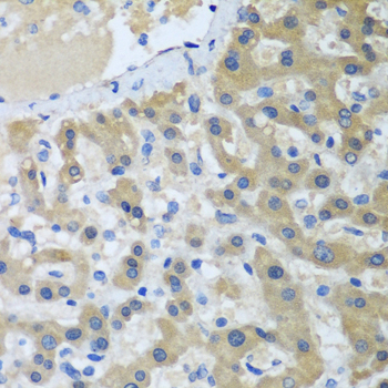 XPC Rabbit Polyclonal Antibody