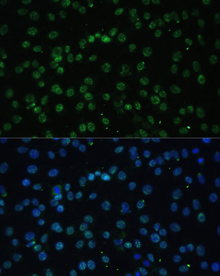 DDX39B Rabbit Polyclonal Antibody