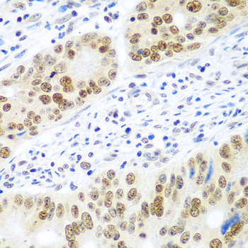 MDC1 Rabbit Polyclonal Antibody