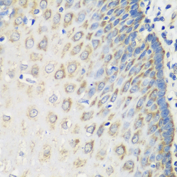 MSRB2 Polyclonal Antibody