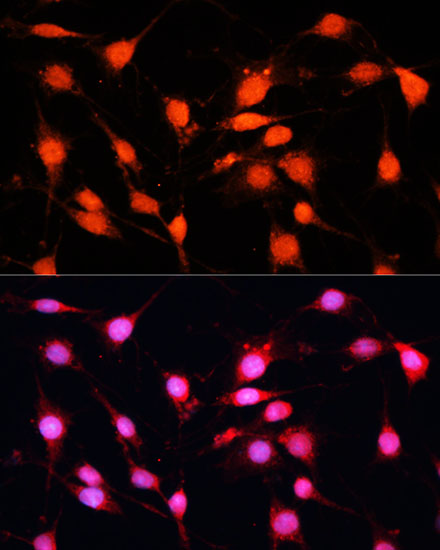 METTL3 Polyclonal Antibody