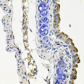 MARK1 Rabbit Polyclonal Antibody