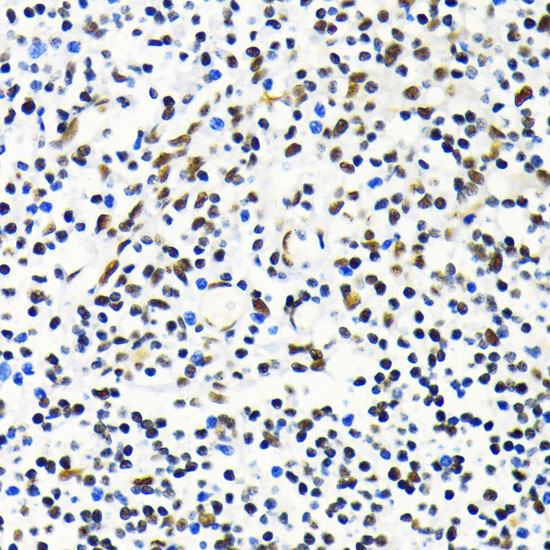 MKL1 Rabbit Polyclonal Antibody
