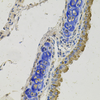 GAS6 Rabbit Polyclonal Antibody
