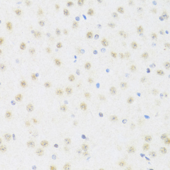 DDX50 Rabbit Polyclonal Antibody